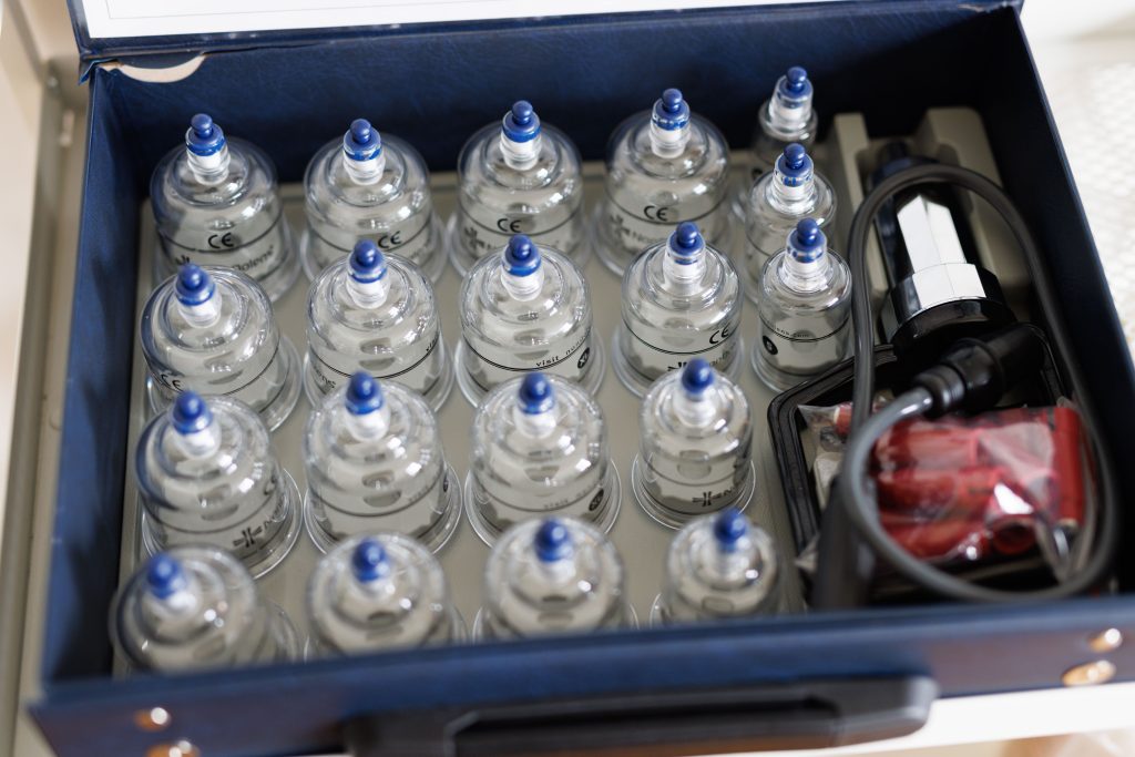 Köpölyözéshez használt professzionális eszközkészlet, átlátszó üvegharangokkal és pumpával.